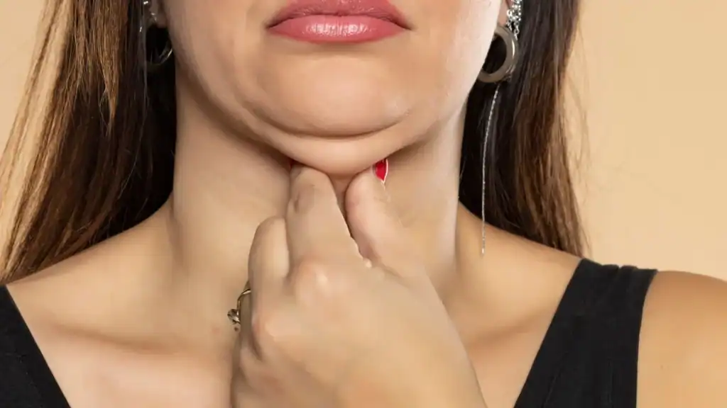 An image of a woman with double chin, sad, worried : Non Surgical Double Chin Removal Treatment in Shropshire , UK