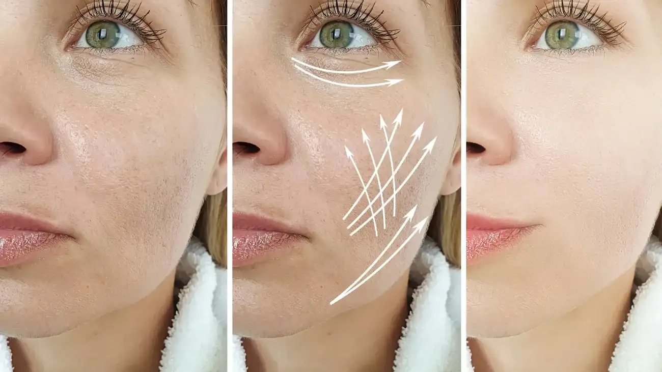Can One Treatment Really Tackle More Than One Skin Concern Shropshire ?
