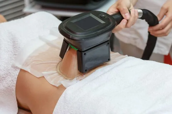 Image of person having fat freezing treatment to help weight gain Shropshire