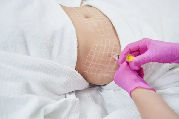 image of fat dissolving injections on love handles to help combat weight gain Shropshire