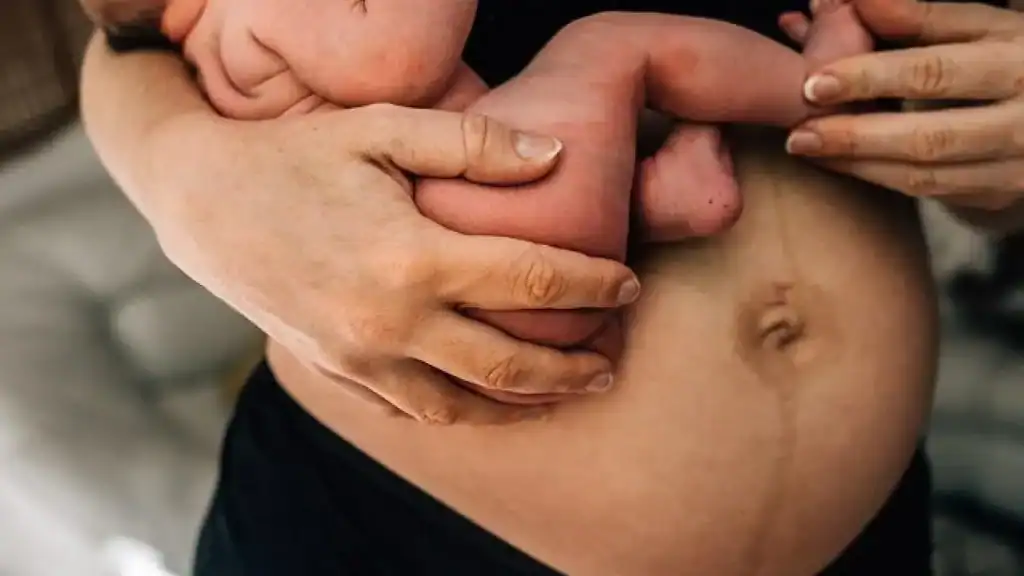 Why Is My Stomach Still Big After Pregnancy Shropshire ?