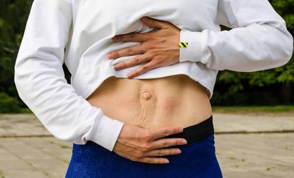 When Could Diastasis Recti Be the Missing Piece of the Puzzle Shropshire ?